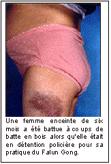 Image for article CIFD : Une pratiquante de Falun Gong enceinte de six mois a été durement battue par la police chinoise