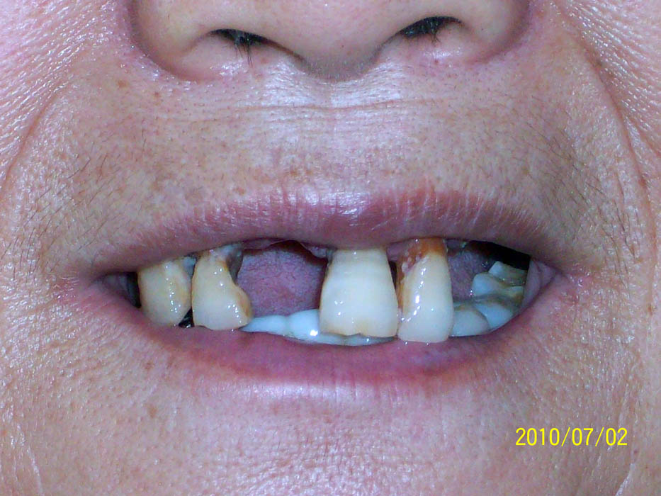 Image for article Atrocités commises au Centre de lavage de cerveau de Zhangjiatun à Jiaozhou, province du Shandong