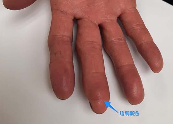 Image for article Après avoir commencé à pratiquer, des miracles se sont produits