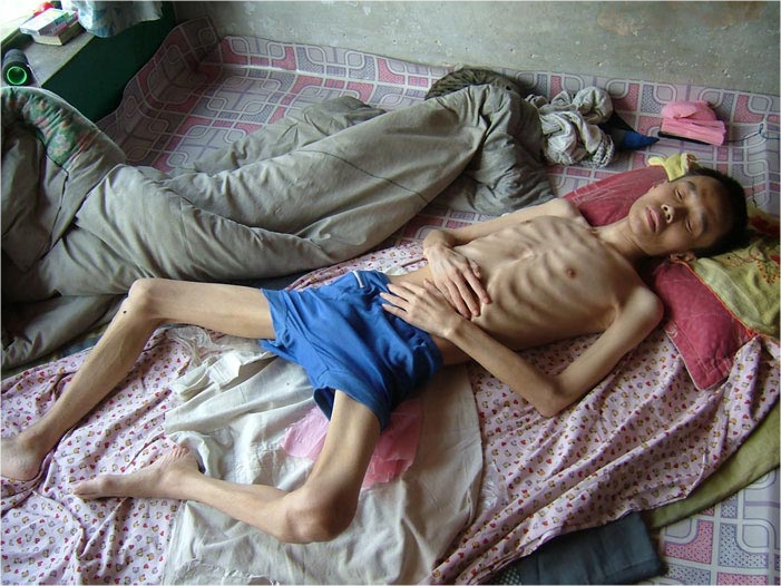 Image for article Un ancien professeur d'anglais licencié huit fois et presque mort en purgeant une peine de prison de sept ans pour sa croyance